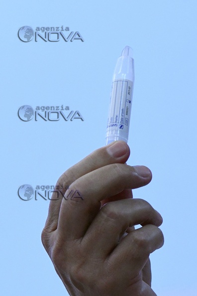 Covid 19, presentato allo Spallanzani test salivare 