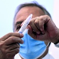 Covid 19, presentato allo Spallanzani test salivare 